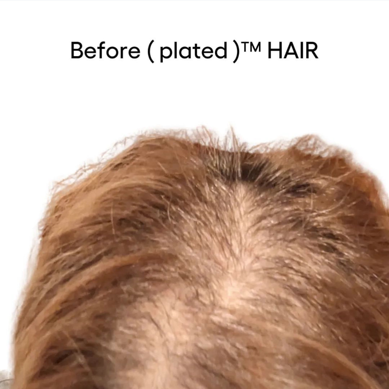 Plated Exosomes Serum: (HAIR)