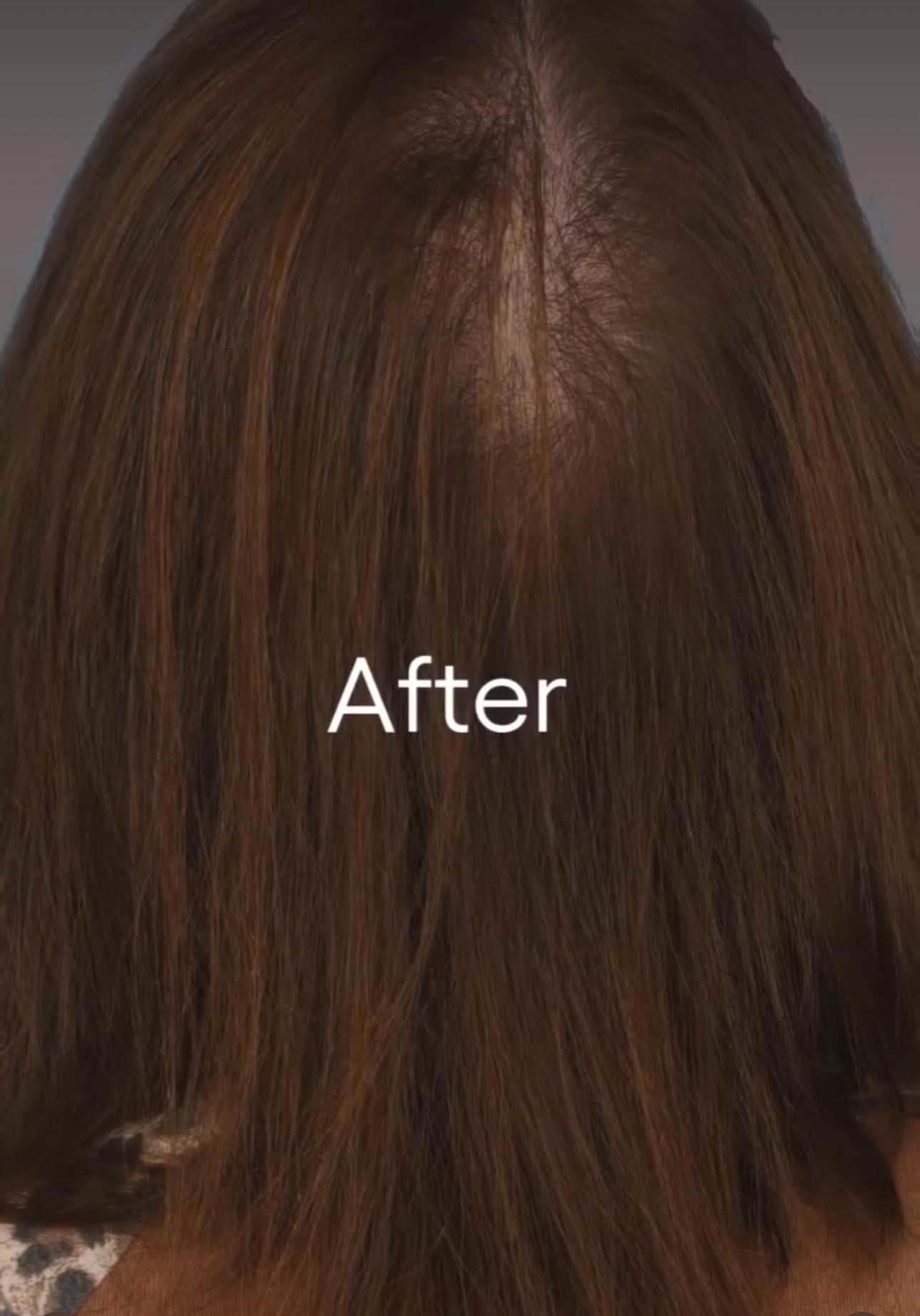 Plated Exosomes Serum: (HAIR)