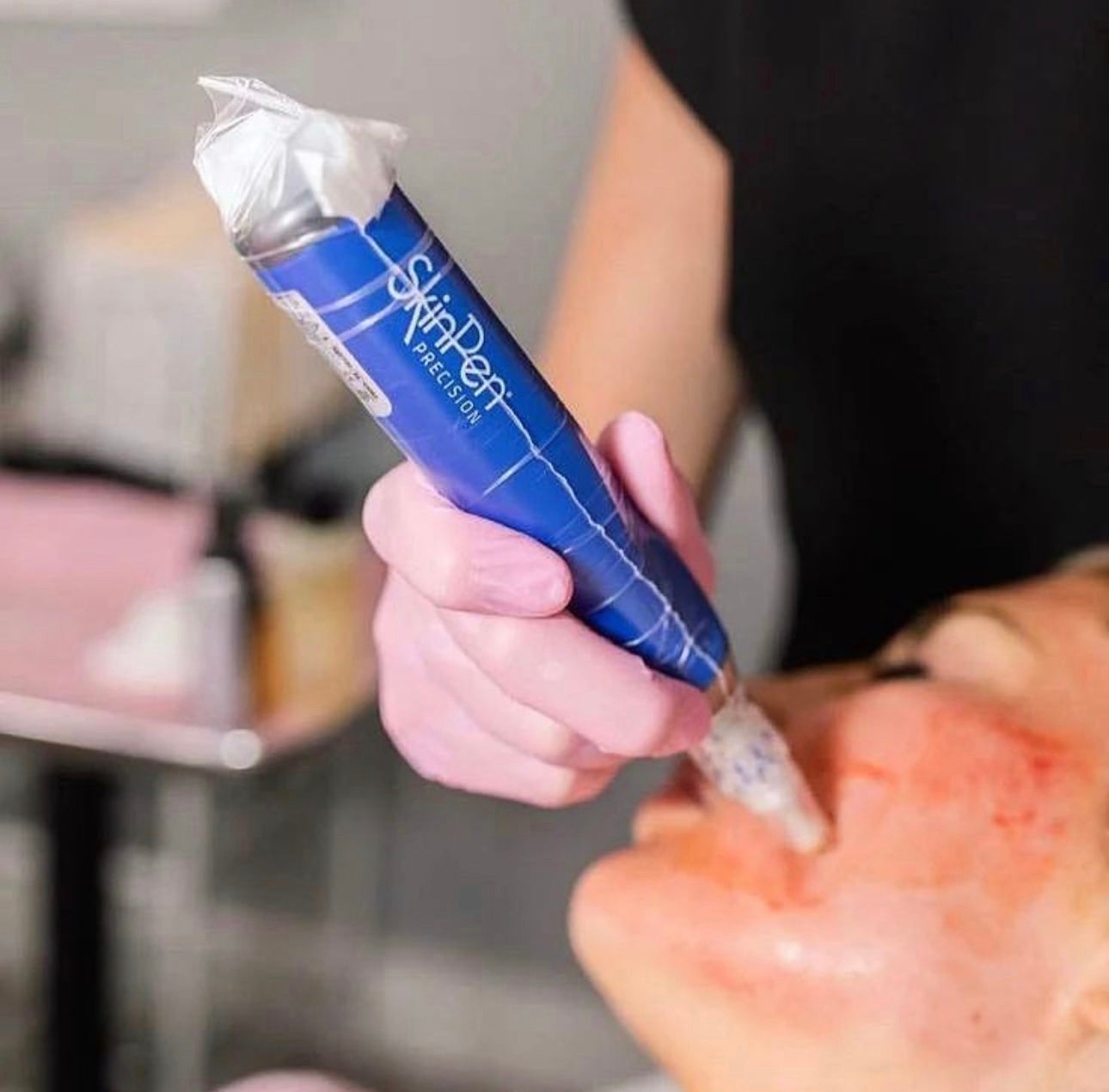 Collagen Induction Therapy: Skinpen Microneedling (Single) *Service