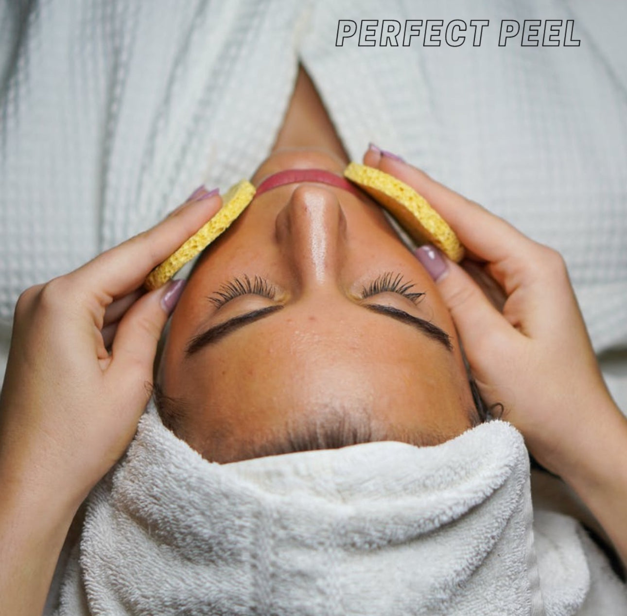 Chemical Peel: The Perfect DermaPeel (Single) *Service