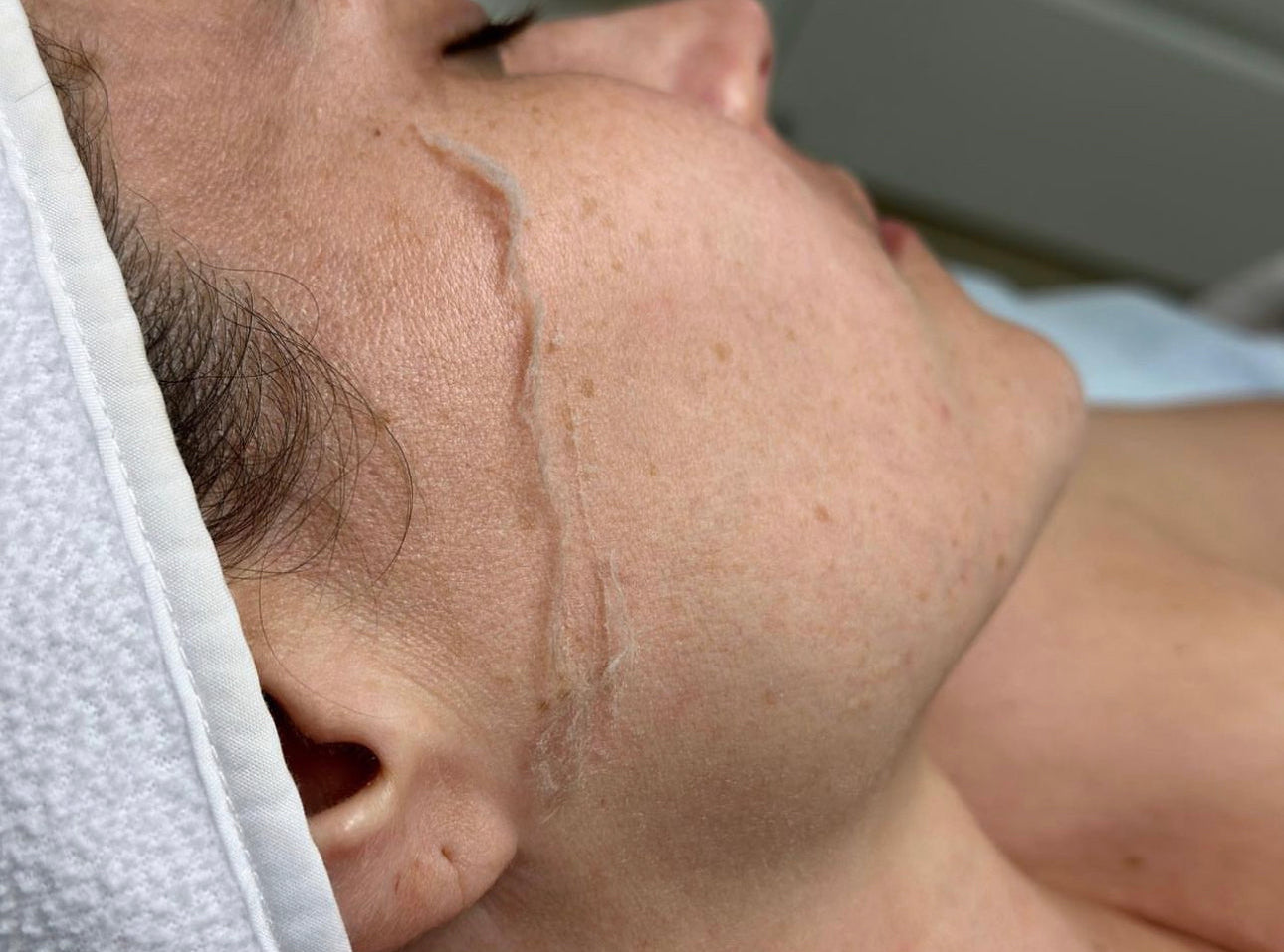 Dermaplaning (Add-on Service) *Service