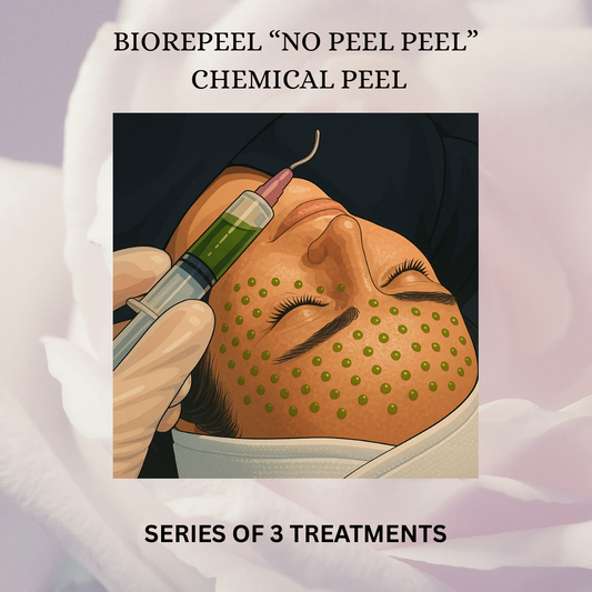 BioSkin BioRepeel TCA Peel (Series of 3) *Service