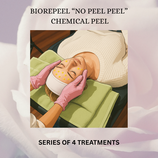 BioSkin BioRepeel TCA Peel (Series of 4) *Service