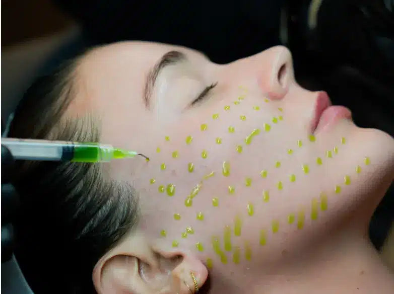 BioSkin BioRepeel TCA Peel (Single) *Service