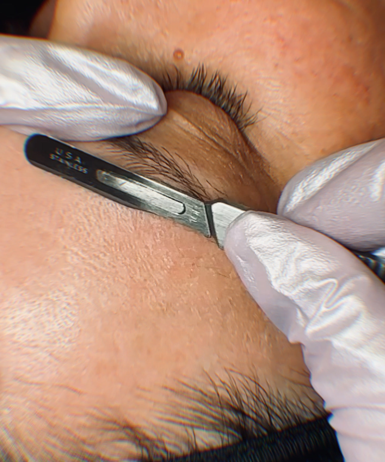 Dermaplaning (Add-on Service) *Service