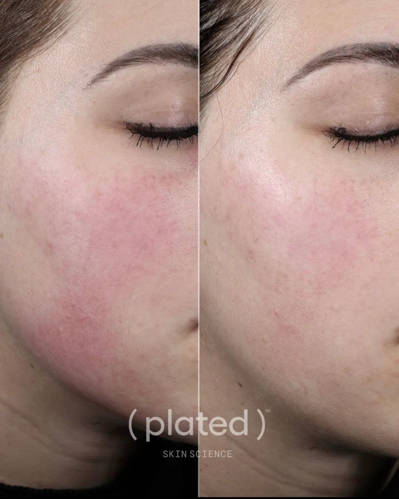 Plated intense serum 2025 before and after