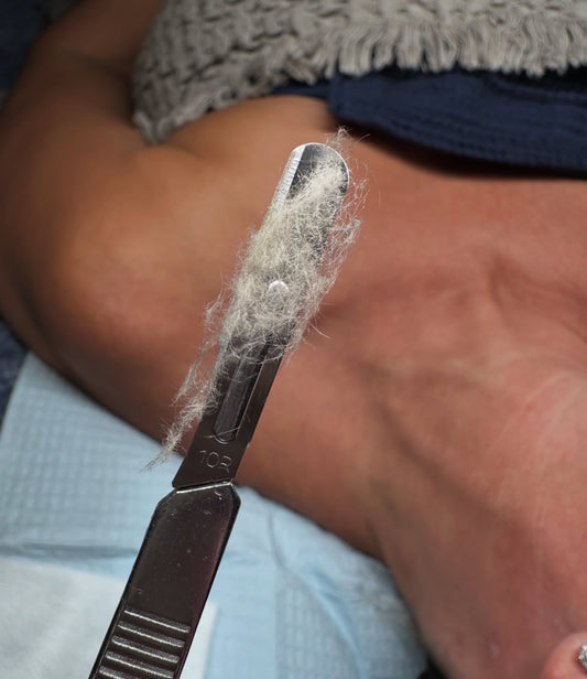 Dermaplaning Facial